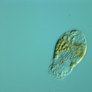 The rotifer Elosa spec.