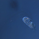 The ciliate Urosomoida spec.
